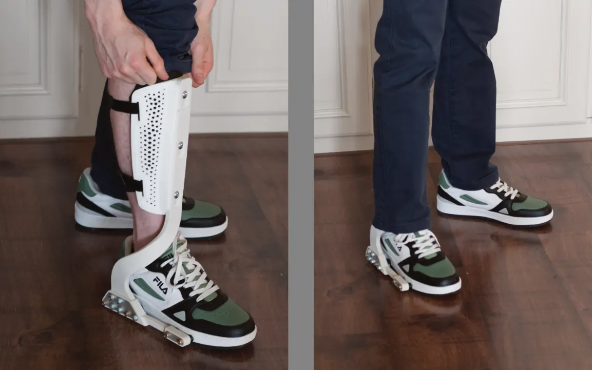 Ankle foot orthosis